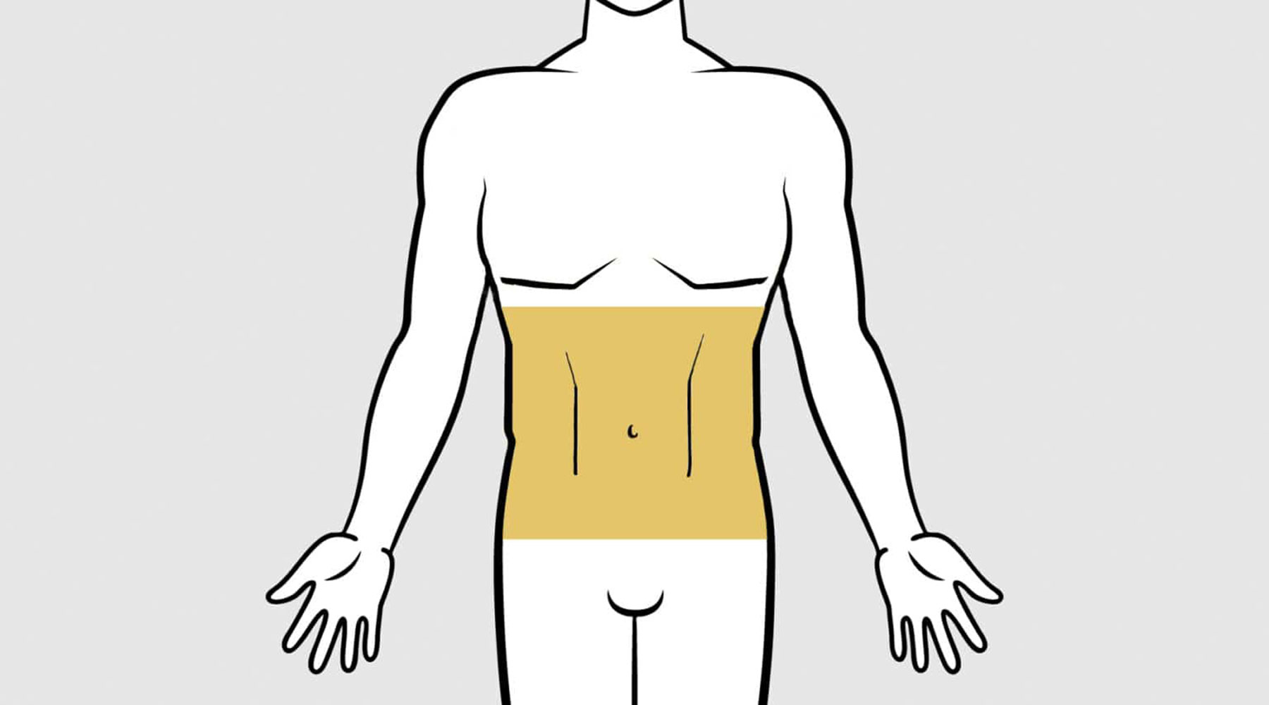 Diagram of abdominal areas treated with hi-def liposuction