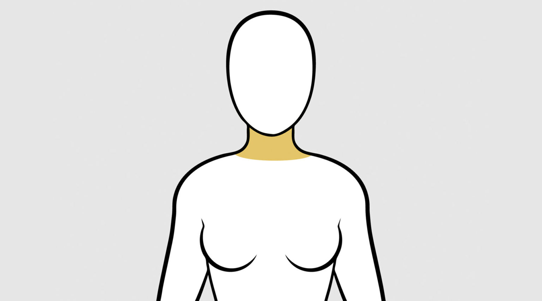 Diagram of the double chin treatment area